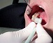 歯科医に聞く。この治療はいい方法？